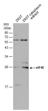 293T whole cell and cytoplasm extracts (30 μg) were separated by 12% SDS-PAGE, and the membrane was blotted with eIF4E antibody (GTX132092) diluted at 1:1000.