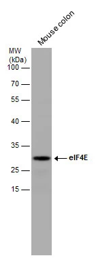 Mouse tissue extract (50 μg) was separated by 12% SDS-PAGE, and the membrane was blotted with eIF4E antibody (GTX132092) diluted at 1:1000.
