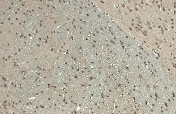 BARD1 antibody detects BARD1 protein at nucleus by immunohistochemical analysis. Sample: Paraffin-embedded mouse brain. BARD1 stained by BARD1 antibody (GTX132094) diluted at 1:500. Antigen Retrieval: Citrate buffer, pH 6.0, 15 min