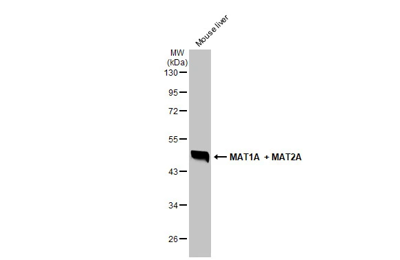 Mouse tissue extract (50 μg) was separated by 10% SDS-PAGE, and the membrane was blotted with MAT1A + MAT2A antibody (GTX132095) diluted at 1:1000. The HRP-conjugated anti-rabbit IgG antibody (GTX213110-01) was used to detect the primary antibody.