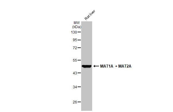 Rat tissue extract (50 μg) was separated by 10% SDS-PAGE, and the membrane was blotted with MAT1A + MAT2A antibody (GTX132095) diluted at 1:1000. The HRP-conjugated anti-rabbit IgG antibody (GTX213110-01) was used to detect the primary antibody.