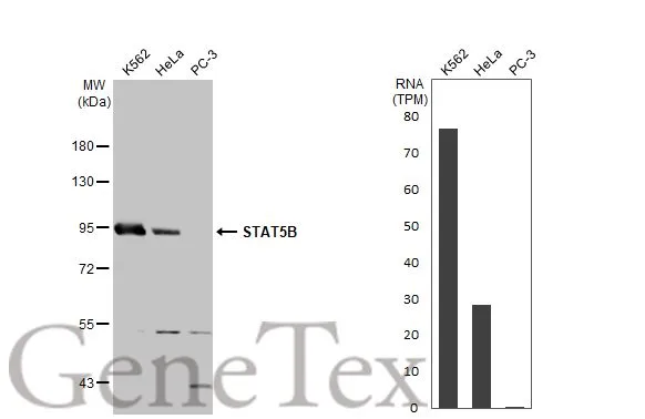 Various whole cell extracts (30 μg) were separated by 7.5% SDS-PAGE, and the membrane was blotted with STAT5B antibody (GTX132113) diluted at 1:1000. The HRP-conjugated anti-rabbit IgG antibody (GTX213110-01) was used to detect the primary antibody.