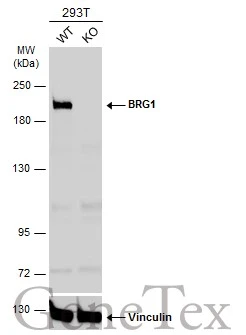 Wild-type (WT) and BRG1 knockout (KO) 293T cell extracts (30 μg) were separated by 5% SDS-PAGE, and the membrane was blotted with BRG1 antibody (GTX132121) diluted at 1:2000. The HRP-conjugated anti-rabbit IgG antibody (GTX213110-01) was used to detect the primary antibody. Wild-type (WT) and BRG1 knockout (KO) 293T cell extracts (30 μg) were separated by 5% SDS-PAGE, and the membrane was blotted with BRG1 antibody (GTX132121) diluted at 1:2000. The HRP-conjugated anti-rabbit IgG antibody (GTX213110-01) was used to detect the primary antibody.