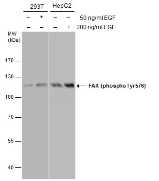 FAK (phospho Tyr576) antibody detects FAK (phospho Tyr576) protein by western blot analysis. Left: Untreated (-) and EGF-treated (+, 50 ng/ml for 30 min) 293T whole cell extracts (30 μg) were separated by 7.5% SDS-PAGE. Right: Untreated (-) and EGF-treated (+, 200 ng/ml for 30 min) HepG2 whole cell extracts (30 μg) were separated by 7.5% SDS-PAGE. The membranes were blotted with FAK (phospho Tyr576) antibody (GTX132140) diluted at 1:3000.