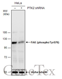 Non-transfected (–) and transfected (+) HeLa whole cell extracts (50 μg) were separated by 7.5% SDS-PAGE, and the membrane was blotted with FAK (phospho Tyr576) antibody (GTX132140) diluted at 1:500.