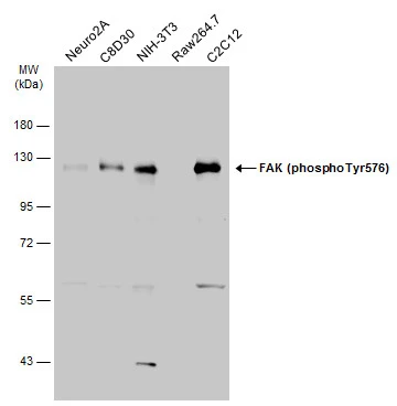 Various whole cell extracts (30 μg) were separated by 7.5% SDS-PAGE, and the membrane was blotted with FAK (phospho Tyr576) antibody (GTX132140) diluted at 1:1000. The HRP-conjugated anti-rabbit IgG antibody (GTX213110-01) was used to detect the primary antibody.