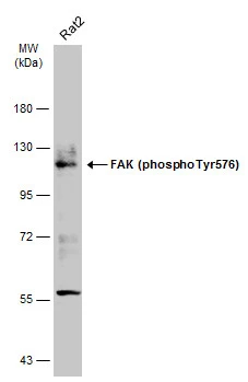 Whole cell extract (30 μg) was separated by 7.5% SDS-PAGE, and the membrane was blotted with FAK (phospho Tyr576) antibody (GTX132140) diluted at 1:1000. The HRP-conjugated anti-rabbit IgG antibody (GTX213110-01) was used to detect the primary antibody.