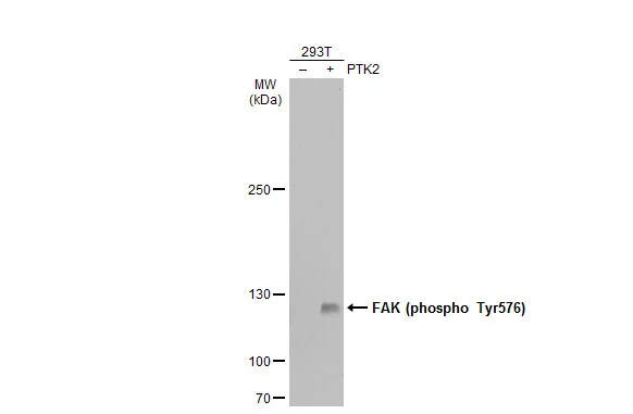 Non-transfected (–) and transfected (+) 293T whole cell extracts (30 μg) were separated by 5% SDS-PAGE, and the membrane was blotted with FAK (phospho Tyr576) antibody (GTX132140) diluted at 1:500. The HRP-conjugated anti-rabbit IgG antibody (GTX213110-01) was used to detect the primary antibody.