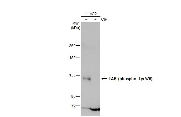 Untreated (–) and treated (+) HepG2 whole cell extracts (30 μg) were separated by 5% SDS-PAGE, and the membrane was blotted with FAK (phospho Tyr576) antibody (GTX132140) diluted at 1:500. The HRP-conjugated anti-rabbit IgG antibody (GTX213110-01) was used to detect the primary antibody.