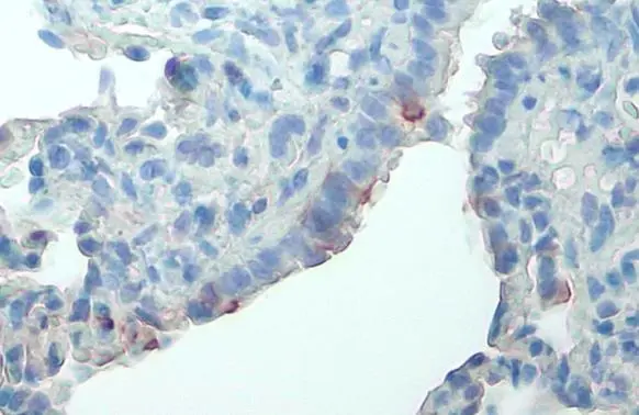 FAK (phospho Tyr576) antibody detects FAK (phospho Tyr576) protein at cell membrane by immunohistochemical analysis. Sample: Paraffin-embedded rat lung. FAK (phospho Tyr576) stained by FAK (phospho Tyr576) antibody (GTX132140) diluted at 1:500. Antigen Retrieval: Citrate buffer, pH 6.0, 15 min