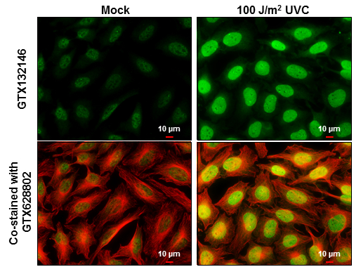 Anti-ATM (phospho Ser1981) antibody (GTX132146) | GeneTex