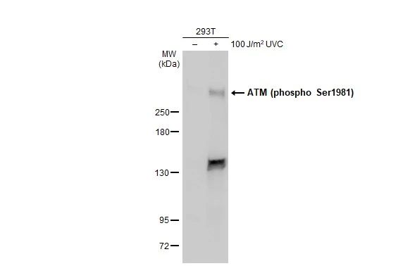 Anti-ATM (phospho Ser1981) antibody (GTX132146) | GeneTex