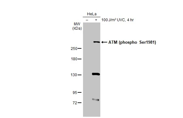 その他 dnk Anti-Mre11 antibody [12D7] (GTX70212) | GeneTex