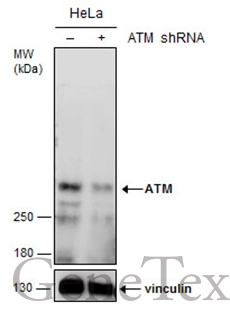 Non-transfected (–) and transfected (+) HeLa whole cell extracts (60 μg) were separated by 5% SDS-PAGE, and the membrane was blotted with ATM antibody (GTX132147) diluted at 1:500.