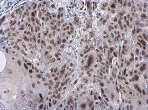 Rad17 (phospho Ser656) antibody