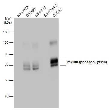 Various whole cell extracts (30 μg) were separated by 7.5% SDS-PAGE, and the membrane was blotted with Paxillin (phospho Tyr118) antibody (GTX132152) diluted at 1:500. The HRP-conjugated anti-rabbit IgG antibody (GTX213110-01) was used to detect the primary antibody.