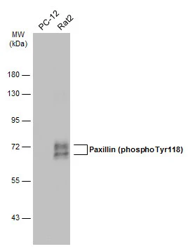 Various whole cell extracts (30 μg) were separated by 7.5% SDS-PAGE, and the membrane was blotted with Paxillin (phospho Tyr118) antibody (GTX132152) diluted at 1:500. The HRP-conjugated anti-rabbit IgG antibody (GTX213110-01) was used to detect the primary antibody.
