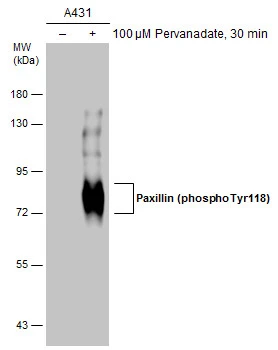 Untreated (–) and treated (+) A431 whole cell extracts (5 μg) were separated by 7.5% SDS-PAGE, and the membrane was blotted with Paxillin (phospho Tyr118) antibody (GTX132152) diluted at 1:1000. The HRP-conjugated anti-rabbit IgG antibody (GTX213110-01) was used to detect the primary antibody.