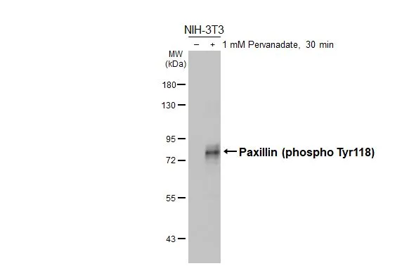 Untreated (–) and treated (+) NIH-3T3 whole cell extracts were separated by 7.5% SDS-PAGE, and the membrane was blotted with Paxillin (phospho Tyr118) antibody (GTX132152) diluted at 1:50000. The HRP-conjugated anti-rabbit IgG antibody (GTX213110-01) was used to detect the primary antibody.