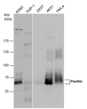 Various whole cell extracts (30 μg) were separated by 7.5% SDS-PAGE, and the membrane was blotted with Paxillin antibody (GTX132153) diluted at 1:1000.