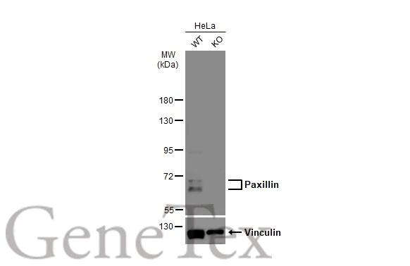 Wild-type (WT) and Paxillin knockout (KO) HeLa cell extracts (30 μg) were separated by 7.5% SDS-PAGE, and the membrane was blotted with Paxillin antibody (GTX132153) diluted at 1:2000. The HRP-conjugated anti-rabbit IgG antibody (GTX213110-01) was used to detect the primary antibody.