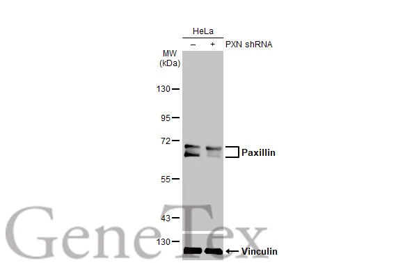 Non-transfected (–) and transfected (+) HeLa whole cell extracts (50 μg) were separated by 7.5% SDS-PAGE, and the membrane was blotted with Paxillin antibody (GTX132153) diluted at 1:2000. The HRP-conjugated anti-rabbit IgG antibody (GTX213110-01) was used to detect the primary antibody.