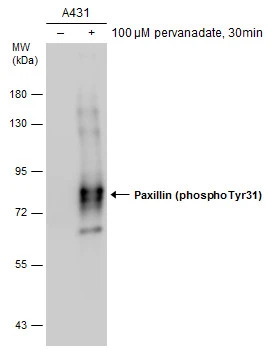 Untreated (–) and treated (+) A431 whole cell extracts (5 μg) were separated by 7.5% SDS-PAGE, and the membrane was blotted with Paxillin (phospho Tyr31) antibody (GTX132154) diluted at 1:1000.