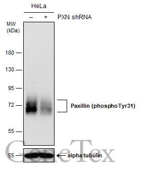 Non-transfected (–) and transfected (+) HeLa whole cell extracts (50 μg) were separated by 7.5% SDS-PAGE, and the membrane was blotted with Paxillin (phospho Tyr31) antibody (GTX132154) diluted at 1:2000.