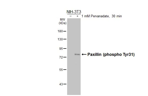 Untreated (–) and treated (+) NIH-3T3 whole cell extracts (30 μg) were separated by 7.5% SDS-PAGE, and the membrane was blotted with Paxillin (phospho Tyr31) antibody (GTX132154) diluted at 1:1000. The HRP-conjugated anti-rabbit IgG antibody (GTX213110-01) was used to detect the primary antibody.