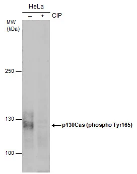 Untreated (–) and treated (+) HeLa whole cell extracts (30 μg) were separated by 5% SDS-PAGE, and the membrane was blotted with p130Cas (phospho Tyr165) antibody (GTX132160) diluted at 1:500. (CIP: Calf-intestinal alkaline phosphatase)