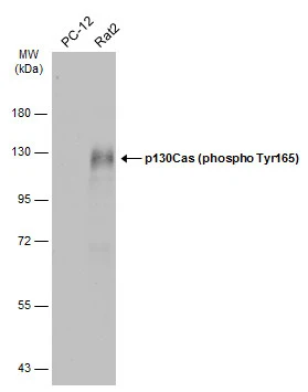 Various whole cell extracts (30 μg) were separated by 7.5% SDS-PAGE, and the membrane was blotted with p130Cas (phospho Tyr165) antibody (GTX132160) diluted at 1:500. The HRP-conjugated anti-rabbit IgG antibody (GTX213110-01) was used to detect the primary antibody.