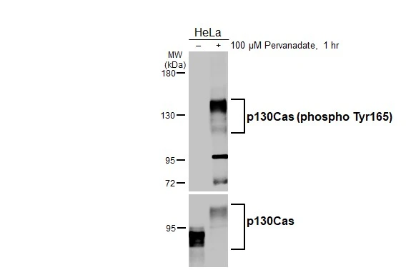 Untreated (–) and treated (+) HeLa whole cell extracts (30 μg) were separated by 5% SDS-PAGE, and the membrane was blotted with p130Cas (phospho Tyr165) antibody (GTX132160) diluted at 1:10000. The HRP-conjugated anti-rabbit IgG antibody (GTX213110-01) was used to detect the primary antibody.