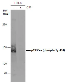 Untreated (–) and treated (+) HeLa whole cell extracts (30 μg) were separated by 5% SDS-PAGE, and the membrane was blotted with p130Cas (phospho Tyr410) antibody (GTX132162) diluted at 1:1000. (CIP: Calf-intestinal alkaline phosphatase)