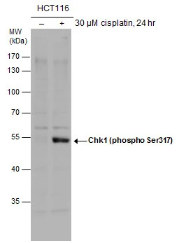 Untreated (–) and treated (+) HCT116 whole cell extracts (30 μg) were separated by 10% SDS-PAGE, and the membrane was blotted with Chk1 (phospho Ser317) antibody (GTX132170) diluted at 1:500. Untreated (–) and treated (+) HCT116 whole cell extracts (30 μg) were separated by 10% SDS-PAGE, and the membrane was blotted with Chk1 (phospho Ser317) antibody (GTX132170) diluted at 1:500.