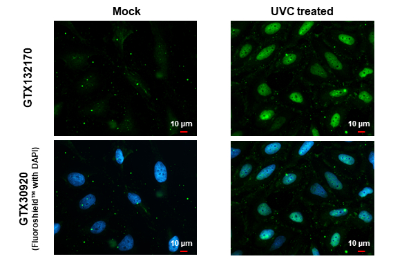 Chk1 (phospho Ser317) antibody detects Chk1 (phospho Ser317) protein at nucleus by immunofluorescent analysis. Sample: Mock and treated HeLa cells were fixed in 4% paraformaldehyde at RT for 15 min. Green: Chk1 (phospho Ser317) stained by Chk1 (phospho Ser317) antibody (GTX132170) diluted at 1:50. Red: alpha Tubulin, a cytoskeleton marker, stained by alpha Tubulin antibody [GT114] (GTX628802) diluted at 1:1000. Blue: Fluoroshield with DAPI (GTX30920).