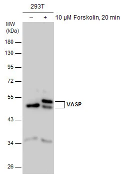 Untreated (–) and treated (+) 293T whole cell extracts (30 μg) were separated by 10% SDS-PAGE, and the membrane was blotted with VASP antibody (GTX132176) diluted at 1:2000.