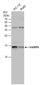 Various whole cell extracts (30 μg) were separated by 15% SDS-PAGE, and the membrane was blotted with VAMP8 antibody (GTX132181) diluted at 1:1000.
