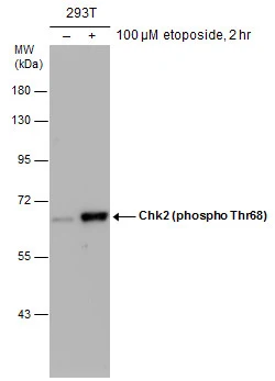 Untreated (–) and treated (+) 293T whole cell extracts (30 μg) were separated by 7.5% SDS-PAGE, and the membrane was blotted with Chk2 (phospho Thr68) antibody (GTX132204) diluted at 1:1000.