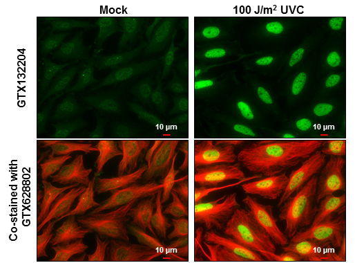 Chk2 (phospho Thr68) antibody detects Chk2 (phospho Thr68) protein at nucleus by immunofluorescent analysis. Sample: Mock and treated HeLa cells were fixed in 4% paraformaldehyde at RT for 15 min. Green: Chk2 (phospho Thr68) stained by Chk2 (phospho Thr68) antibody (GTX132204) diluted at 1:500. Red: alpha Tubulin, a cytoskeleton marker, stained by alpha Tubulin antibody [GT114] (GTX628802) diluted at 1:500. Scale bar= 10 μm.