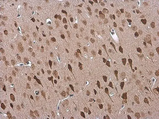 Adenosine A2b Receptor antibody detects Adenosine A2b Receptor protein at cytoplasm in mouse brain by immunohistochemical analysis. Sample: Paraffin-embedded mouse brain. Adenosine A2b Receptor antibody (GTX132217) diluted at 1:500. 
 Antigen Retrieval: Citrate buffer, pH 6.0, 15 min