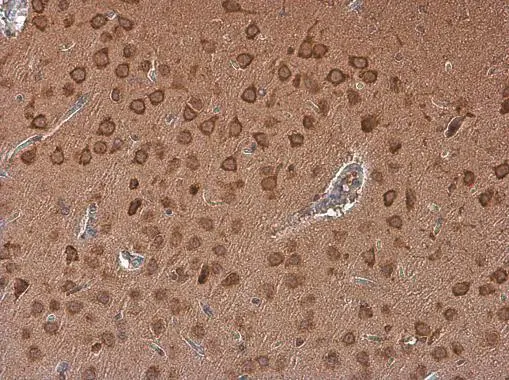Adenosine A2b Receptor antibody detects Adenosine A2b Receptor protein at cytoplasm in rat brain by immunohistochemical analysis. Sample: Paraffin-embedded rat brain. Adenosine A2b Receptor antibody (GTX132217) diluted at 1:500. 
 Antigen Retrieval: Citrate buffer, pH 6.0, 15 min
