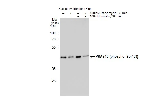 Untreated (–) and treated (+) 293T whole cell extracts (40 μg) were separated by 12% SDS-PAGE, and the membrane was blotted with PRAS40 (phospho Ser183) antibody (GTX132277) diluted at 1:1000. The HRP-conjugated anti-rabbit IgG antibody (GTX213110-01) was used to detect the primary antibody.