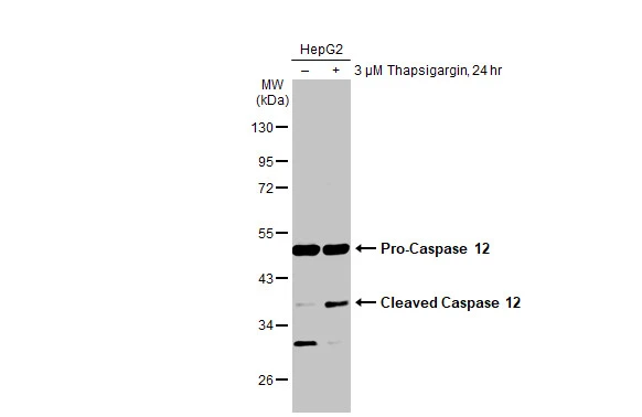 Untreated (–) and treated (+) HepG2 whole cell extracts (30 μg) were separated by 10% SDS-PAGE, and the membrane was blotted with Caspase 12 antibody (GTX132298) diluted at 1:1000. The HRP-conjugated anti-rabbit IgG antibody (GTX213110-01) was used to detect the primary antibody.