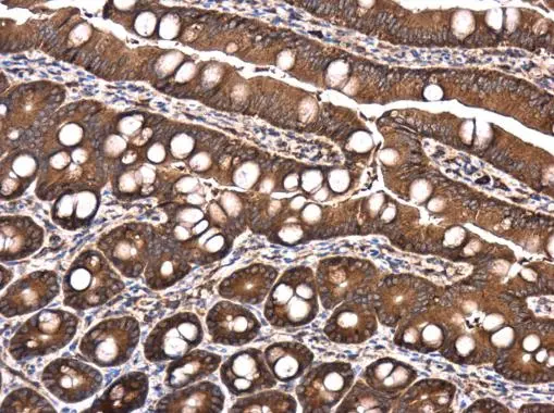 Raptor antibody detects Raptor protein at cytoplasm in rat intestine by immunohistochemical analysis. Sample: Paraffin-embedded rat intestine. Raptor antibody (GTX132303) diluted at 1:1500. 
 Antigen Retrieval: Citrate buffer, pH 6.0, 15 min