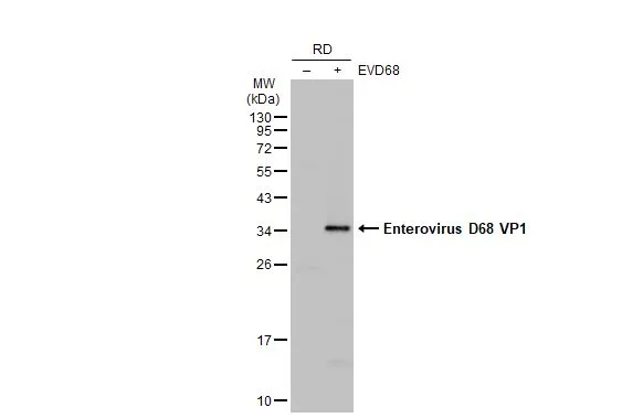 Anti-Enterovirus D68 VP1 antibody (GTX132313) | GeneTex