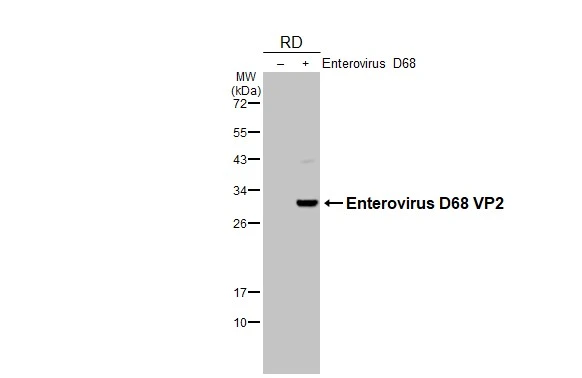 Enterovirus D68 VP2 antibody