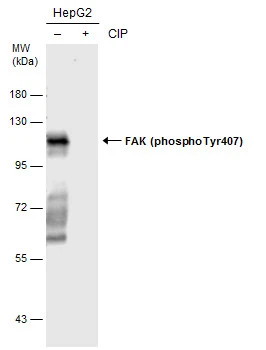 FAK (phospho Tyr407) antibody