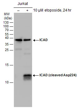 Untreated (–) and treated (+) Jurkat whole cell extracts (30 μg) were separated by 15% SDS-PAGE, and the membrane was blotted with ICAD antibody (GTX132328) diluted at 1:1000.