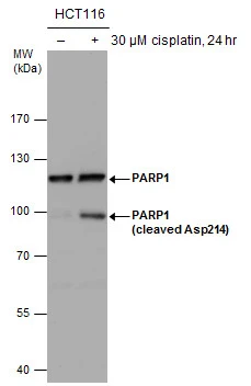 Untreated (–) and treated (+) HCT116 whole cell extracts (30 μg) were separated by 7.5% SDS-PAGE, and the membrane was blotted with PARP antibody (GTX132329) diluted at 1:1000.