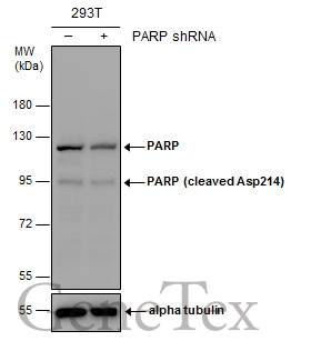 Non-transfected (–) and transfected (+) 293T whole cell extracts (30 μg) were separated by 7.5% SDS-PAGE, and the membrane was blotted with PARP antibody (GTX132329) diluted at 1:3000.